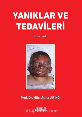 Yanıklar ve Tedavileri 2.Baskı