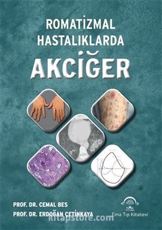 Romatizmal Hastalıklarda Akciğer