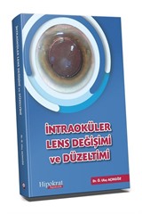 İntraoküler Lens Değişimi ve Düzeltimi