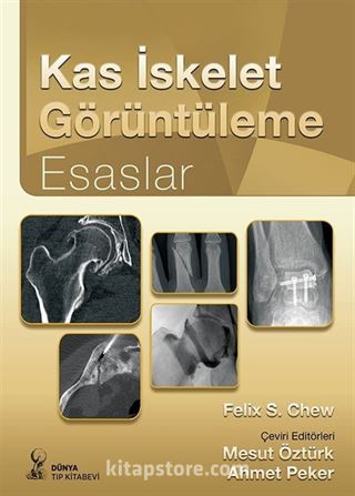 Kas İskelet Görüntüleme: Esaslar