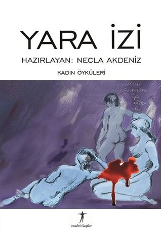 Yara İzi