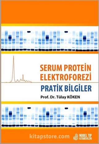 Serum Protein Elektroforezi : Pratik Bilgiler