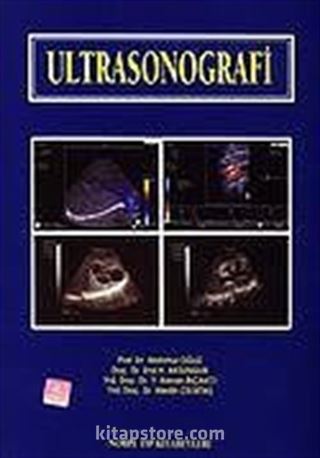 Ultrasonografi